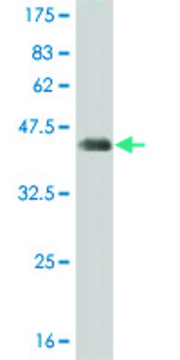 ANTI-T antibody produced in mouse