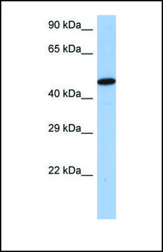 Anti-IRF5 antibody produced in rabbit
