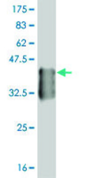 ANTI-T antibody produced in mouse
