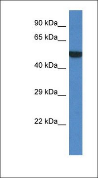 Anti-PORCN antibody produced in rabbit