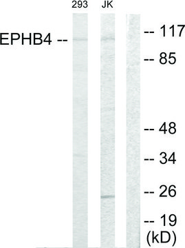Anti-EPHB4 antibody produced in rabbit