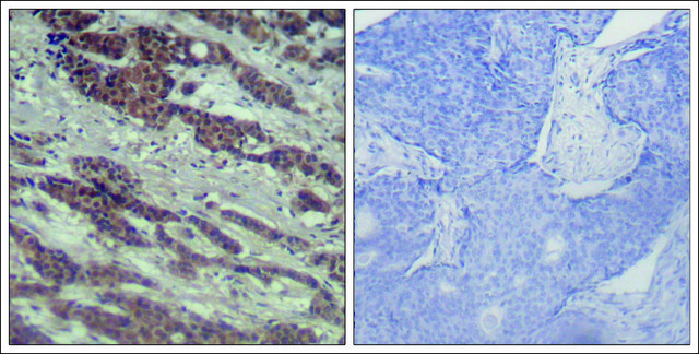 Anti-RAF1 (Ab-338) antibody produced in