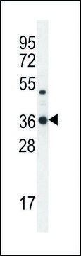 ANTI-TPSD1 (C-TERM) antibody produced in