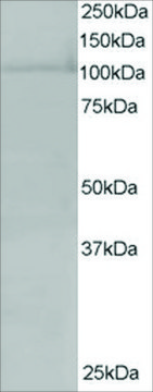 Anti-RANBP16/Ecportin 7 antibody produced in