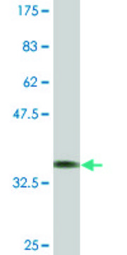 Monoclonal Anti-DRD2, (N-terminal) antibody produced