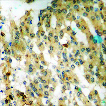 Anti-phospho-GSK3 ? (pSer²¹) antibody produced