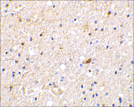 Anti-NADE antibody produced in rabbit