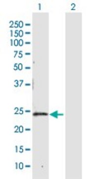 Anti-CBR4 antibody produced in rabbit