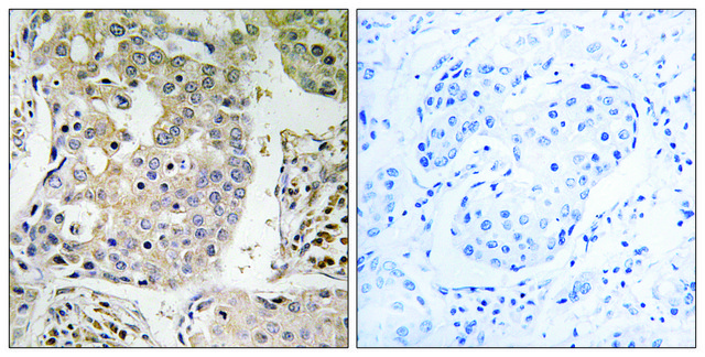 Anti-MRPL41 antibody produced in rabbit