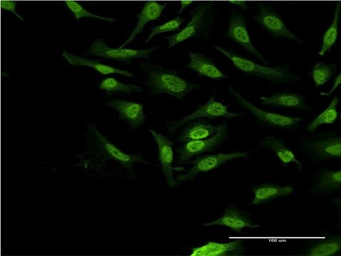 ANTI-PBK antibody produced in mouse