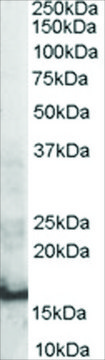 Anti-SH2D1A/SAP antibody produced in goat