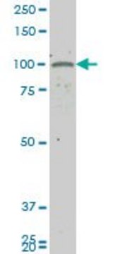 ANTI-GUCY2C antibody produced in mouse