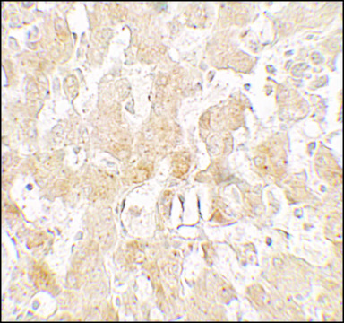 Anti-UCP1 antibody produced in rabbit