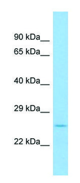 Anti-Fgf9 (N-terminal) antibody produced in