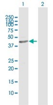 Anti-ALDH3B1 antibody produced in rabbit