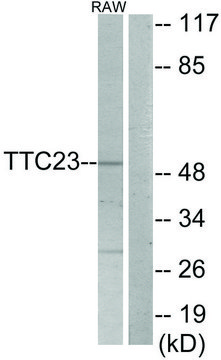 Anti-TTC23 antibody produced in rabbit