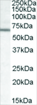 Anti-Dachshund Homolog 2/DACH2 antibody produced