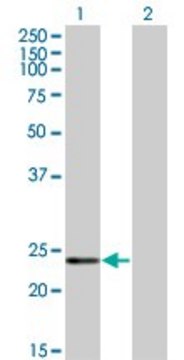 ANTI-RCV1 antibody produced in mouse