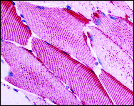 Anti-SLC5A10 antibody produced in rabbit