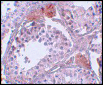 Anti-CLPH antibody produced in rabbit