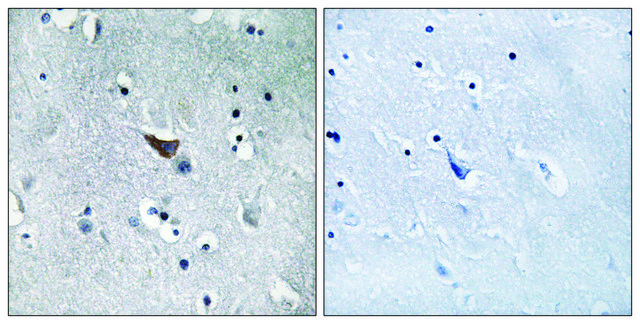 Anti-GLUR1 antibody produced in rabbit