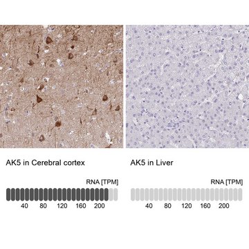 Anti-AK5 antibody produced in rabbit
