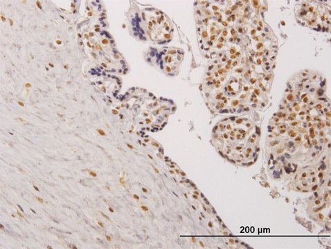 Monoclonal Anti-TESK2, (C-terminal) antibody produced