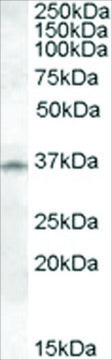 Anti-Cathepsin K antibody produced in