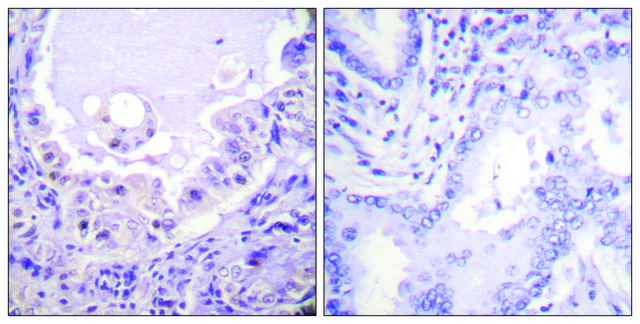 Anti-C-RAF, C-Terminal antibody produced in