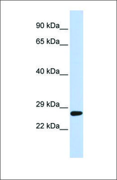 Anti-SETD4 antibody produced in rabbit