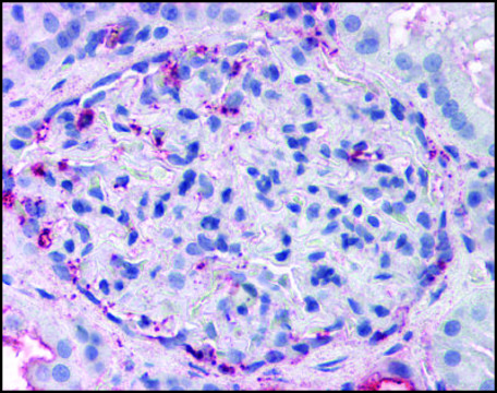 Anti-LUSTR2/GPR108 (AB2) antibody produced in