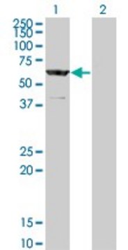 ANTI-CESK1 antibody produced in mouse
