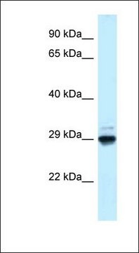 Anti-MAF1 antibody produced in rabbit