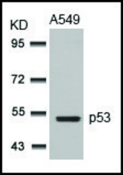 Anti-TP53 (Ab-315) antibody produced in