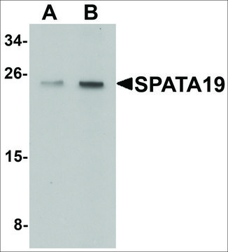 Anti-SPATA19 antibody produced in chicken