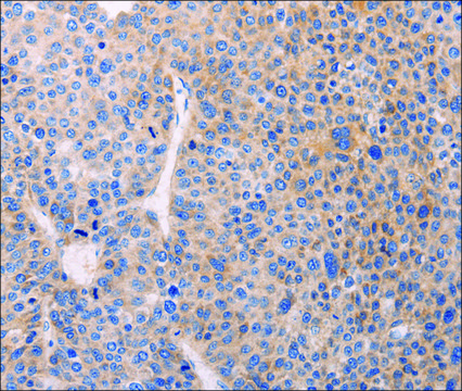 Anti-ADCY1 antibody produced in rabbit