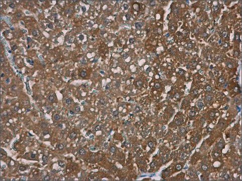 Anti-TRPM2 (N-terminal) antibody produced in