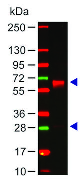 Anti-Human IgA (?-chain specific) antibody