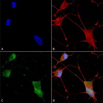 Monoclonal Anti-Neuroligin 3 antibody produced
