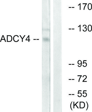 Anti-ADCY4 antibody produced in rabbit