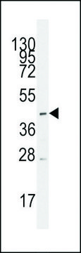 ANTI-MCT1 (SLC16A1) (CENTER) antibody produced