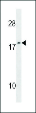 ANTI-NM23 (NME1)(N-TERMINAL) antibody produced in