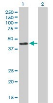 Anti-ACY1 antibody produced in mouse