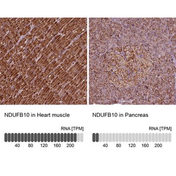 Anti-NDUFB10 antibody produced in rabbit