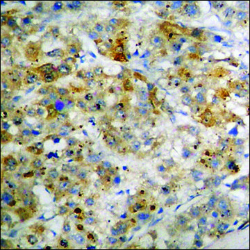 Anti-phospho-p70 S6 Kinase (pThr?²¹) antibody