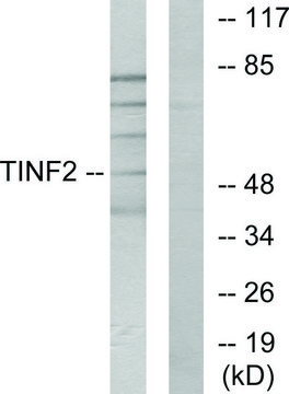 Anti-TINF2 antibody produced in rabbit