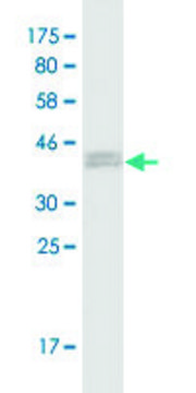 Monoclonal Anti-RABGAP1, (N-terminal) antibody produced