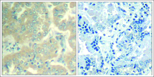 Anti-PTK2 (Ab-576/577) antibody produced in