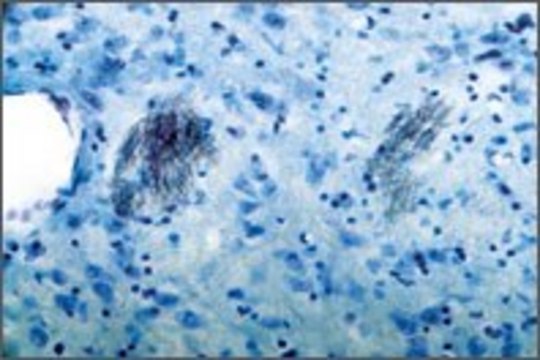 Anti-Purinergic Receptor P2Y? antibody produced