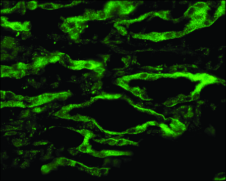 Anti-AQP4 antibody produced in rabbit